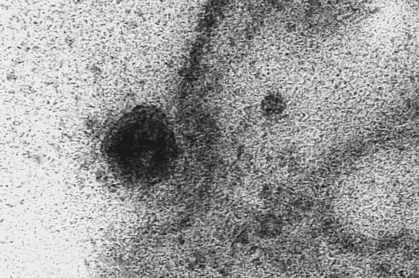 Imagem de microscopia do novo coronavírus (Foto: Débora Barreto/IOC/Fiocruz)