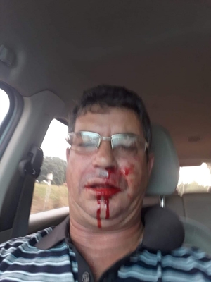 Luis Carlos Formagi denunciou agressão em rede social (Foto: Arquivo Pessoal)