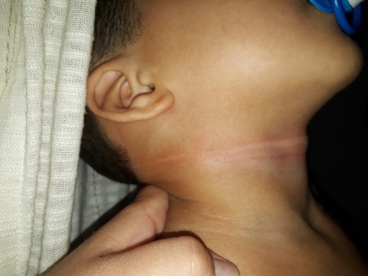 O garoto de três anos tentou se enforcar após assistir vídeo na internet (Foto: Reprodução)