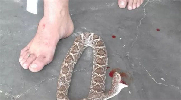 Vereador revida picada de cobra e mata animal com mordida