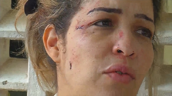 Sacoleira ficou ferida após ônibus cair em ribanceira de rodovia de Mirandópolis — Foto: Reprodução/TV TEM