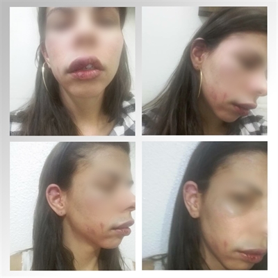 A mulher relatou que o jovem começou a agredi-la com vários socos violentos, principalmente na região dos lábios, face e cabeça (Foto: Reprodução/Facebook)