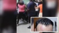 A vítima tentava separar uma briga entre alunos quando viu que a inspetora da escola estava sendo agredida (Foto: Divulgação)