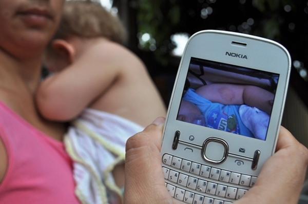 Laudo aponta que mordida em bebê é de adulto